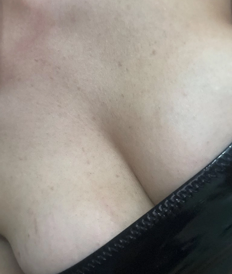 Melissa